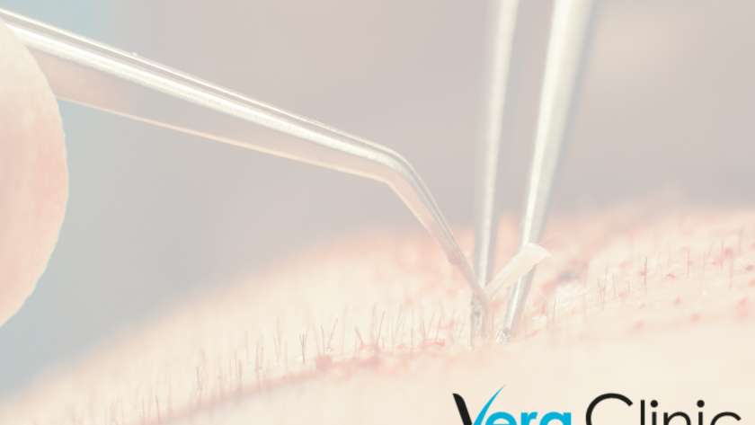 Vera Clinic Logo